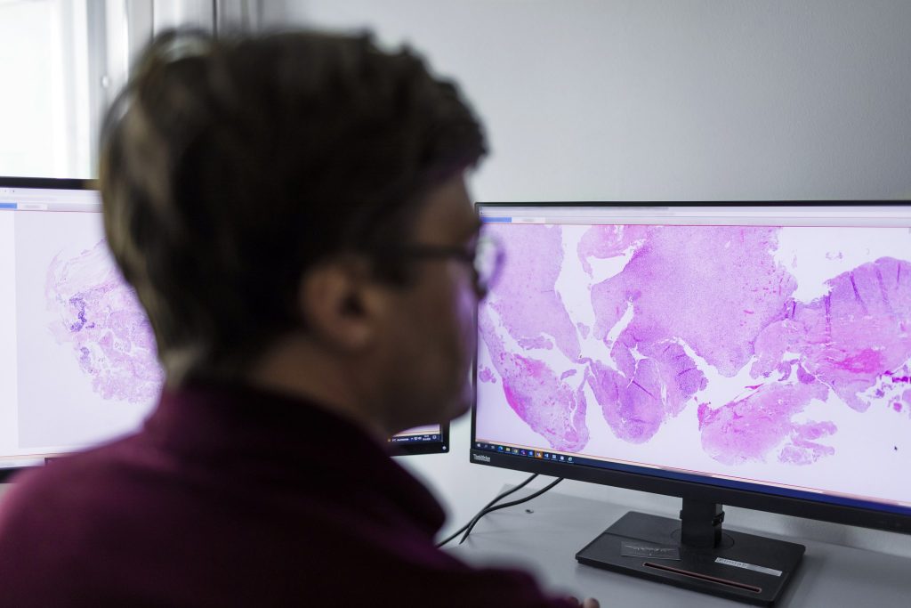 FIMLAB2022_patologia-4136 Laboratoriotyöntekijä tutkimassa näytteitä