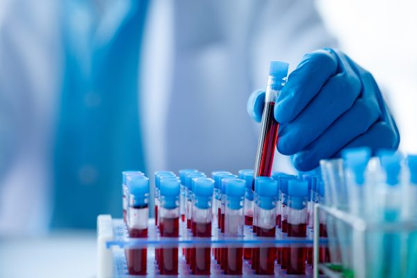 Laboratoriotyöntekijä käsittelee verinäytteitä
